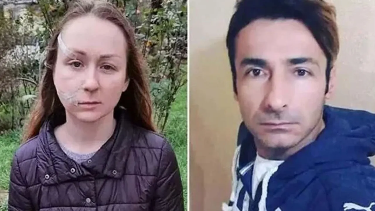 Ukraynalı eşinin yüzünü falçatayla kesen sanığa tahliye