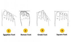 Mısır, Yunan, Alman… Ayak şekliniz hangi milletten olduğunuzu gösteriyor!