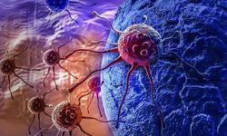 Uzmanlar açıkladı! 6 besin kanseri önlemede çok etkili