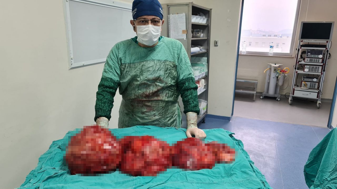 Tokat'ın Turhal ilçesinde yaşayan esnaf Ali Yavuz Çeçen (46) karnında şişkinlik olması nedeni ile kilo aldığını düşünerek diyet yaptı.u0026nbsp;
